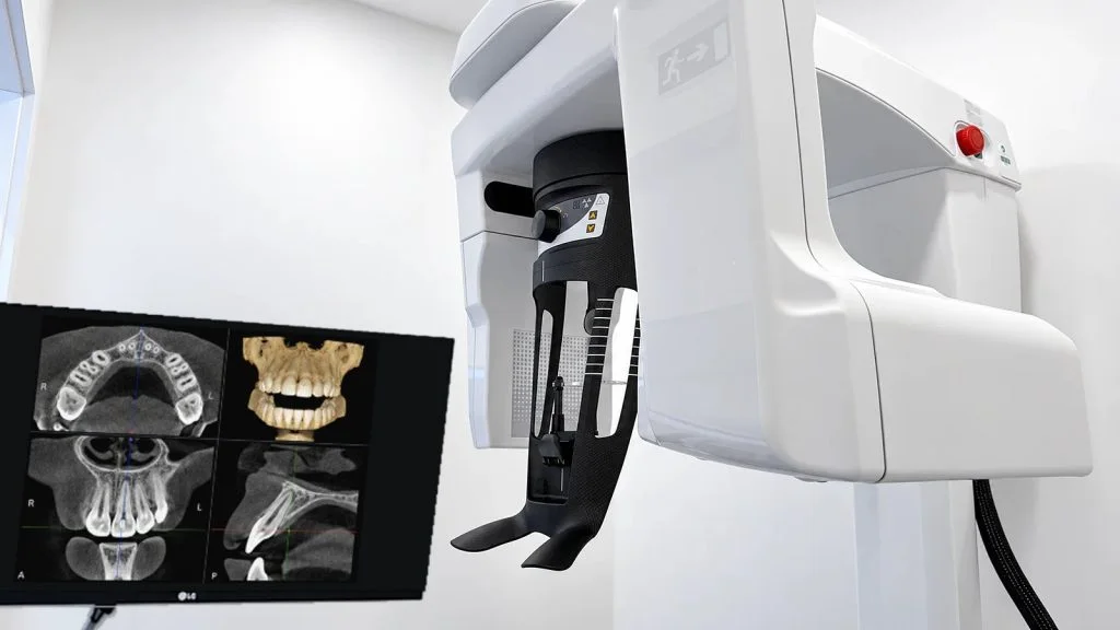 Aparelho de radiografia panorâmica e CBCT da Lusocare Montijo